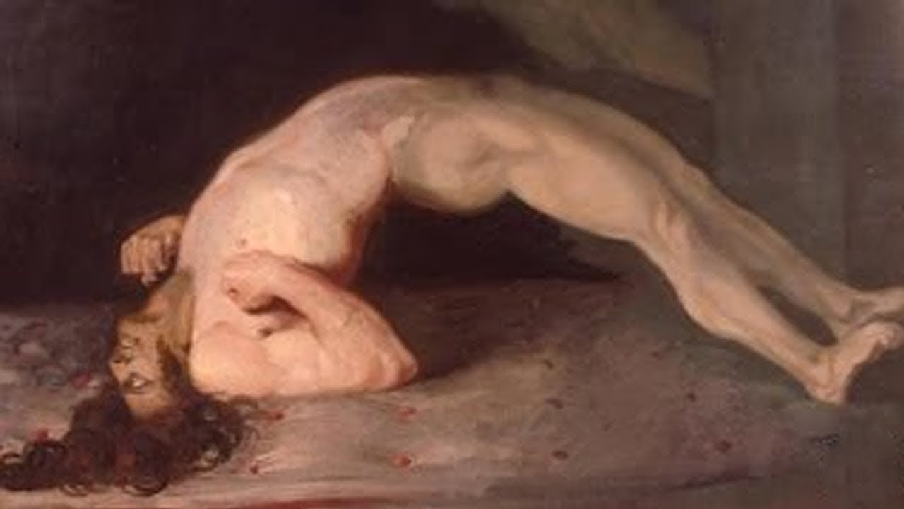 Obraz vojáka umírajícího na tetanus - autor sir Charles Bells Originál je vystavený v Royal College of Surgeons v Edinburghu ve Skotsku.